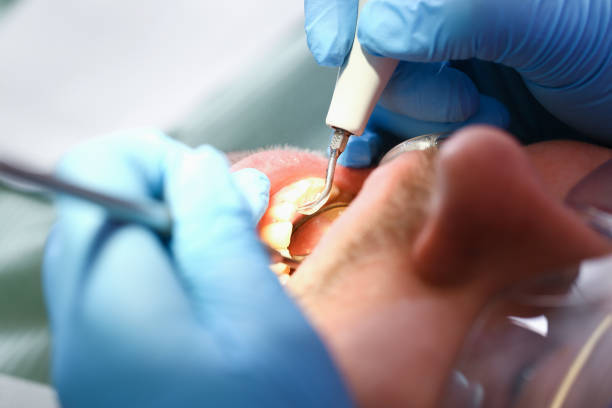 Best Weekend Emergency Dentist in Olmsted Falls, OH