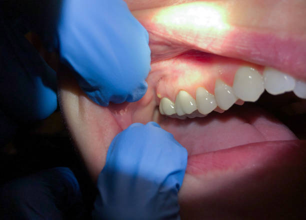 Best Pediatric Emergency Dentist in Olmsted Falls, OH